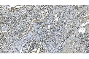 IHC analysis of LSM7 using anti-LSM7 antibody (ABIN7598937). (LSM7 antibody  (AA 1-103))