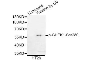 Western blot analysis of extracts of HT-29 cells, using Phospho-CHEK1-Ser280 antibody (ABIN5969878). (CHEK1 antibody  (pSer280))
