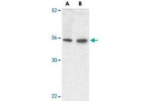 Western blot analysis of TRIM5 gamma expression in human bladder (A) and colon (B) tissue lysate with TRIM5 gamma polyclonal antibody  at 2 ug /mL .