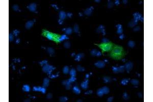 Anti-SHPK mouse monoclonal antibody (ABIN2454805) immunofluorescent staining of COS7 cells transiently transfected by pCMV6-ENTRY SHPK (RC204421). (SHPK antibody)