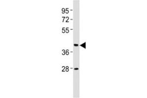 Western blot testing of CB2 antibody at 1:2000 dilution + human brain lysate. (CNR2 antibody  (AA 18-53))