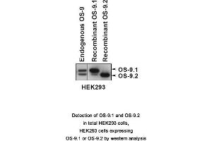 Image no. 1 for anti-Osteosarcoma Amplified 9, Endoplasmic Reticulum Lectin (OS9) (AA 300-400), (Isoform 1) antibody (ABIN363453) (OS9 antibody  (Isoform 1))