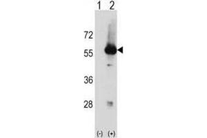 Western Blotting (WB) image for anti-serine/threonine Kinase 3 (STK3) antibody (ABIN2998524) (STK3 antibody)