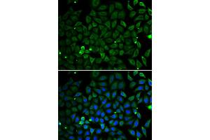 Immunofluorescence analysis of A549 cells using PARK2 antibody (ABIN5998454). (Parkin antibody)