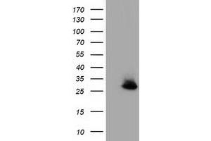 Western Blotting (WB) image for anti-Glutathione S-Transferase theta 2 (GSTT2) antibody (ABIN1498558) (GSTT2 antibody)