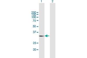 Western Blot analysis of LGALS8 expression in transfected 293T cell line by LGALS8 MaxPab polyclonal antibody. (LGALS8 antibody  (AA 1-317))