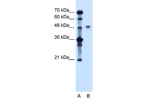 WB Suggested Anti-SLC39A6 Antibody Titration:  1. (SLC39A6 antibody  (Middle Region))