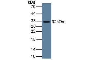 Detection of IL33 in Human Lung Tissue using Monoclonal Antibody to Interleukin 33 (IL33) (IL-33 antibody  (AA 112-270))