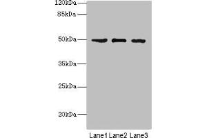 Western blot All lanes: CSNK1G1 antibody at 1. (CSNK1G1 antibody  (Isoform gamma 1))