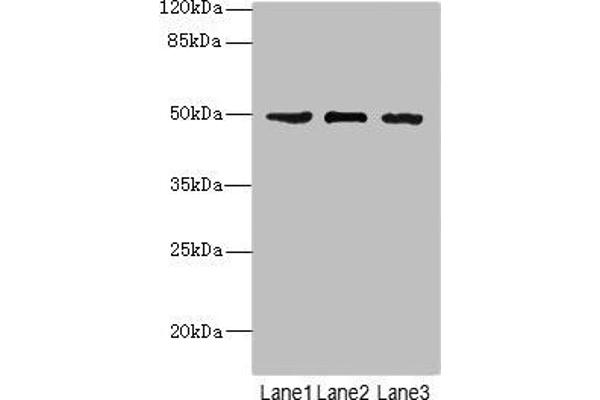 CSNK1G1 抗体  (Isoform gamma 1)