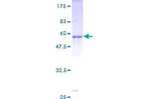 Image no. 1 for Cyclin-Dependent Kinase 1 (CDK1) (AA 1-297) protein (GST tag) (ABIN1348775) (CDK1 Protein (AA 1-297) (GST tag))