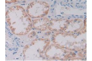 IHC-P analysis of Human Kidney Tissue, with DAB staining. (GDF6 antibody  (AA 336-455))