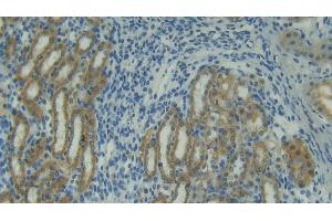 Detection of TRAIL in Rat Kidney Tissue using Polyclonal Antibody to Tumor Necrosis Factor Related Apoptosis Inducing Ligand (TRAIL) (TRAIL antibody  (AA 115-287))