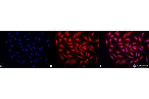 Immunocytochemistry/Immunofluorescence analysis using Rabbit Anti-GRP94 Polyclonal Antibody . (GRP94 antibody  (C-Term) (FITC))