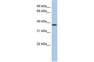 WB Suggested Anti-ZFP36 Antibody Titration:  0. (ZFP36 antibody  (N-Term))