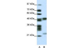WB Suggested Anti-PHF11 Antibody Titration:  0. (PHF11 antibody  (Middle Region))