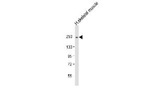 Anti-MYH2 Antibody (N-Term) at 1:2000 dilution + human skeletal muscle lysate Lysates/proteins at 20 μg per lane. (MYH2 antibody  (AA 350-382))