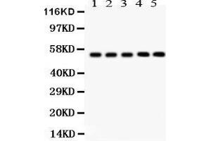 Anti- YB1 Picoband antibody, Western blotting All lanes: Anti YB1  at 0.