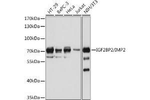 Western blot analysis of extracts of various cell lines, using IGF2BP2/IMP2 antibody (ABIN6131799, ABIN6142242, ABIN6142244 and ABIN6218878) at 1:1000 dilution. (IGF2BP2 antibody  (AA 330-599))