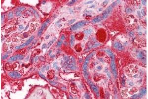 Human Placenta: Formalin-Fixed, Paraffin-Embedded (FFPE) (APOA2 antibody  (AA 1-100))