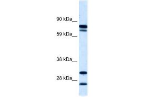 ZNF606 antibody used at 5 ug/ml to detect target protein.