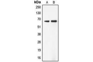 Western blot analysis of ADCK5 expression in Jurkat (A), SW13 (B) whole cell lysates.