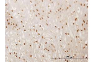 Immunoperoxidase of monoclonal antibody to SMAD6 on formalin-fixed paraffin-embedded human esophagus. (SMAD6 antibody  (AA 285-384))