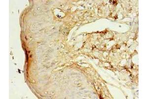 Immunohistochemistry of paraffin-embedded human skin tissue using ABIN7157213 at dilution of 1:100 (Kallikrein 5 antibody  (AA 23-293))