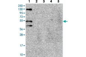 Western blot analysis of Lane 1: RT-4, Lane 2: U-251 MG, Lane 3: Human Plasma, Lane 4: Liver, Lane 5: Tonsil with FUZ polyclonal antibody . (FUZ antibody)