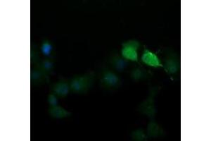 Image no. 1 for anti-SEC14 and Spectrin Domains 1 (SESTD1) antibody (ABIN1501065) (SESTD1 antibody)