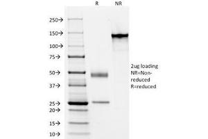SDS-PAGE Analysis of Purified, BSA-Free Acidic Cytokeratin Antibody (clone AE1).