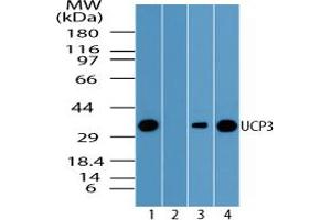 Image no. 1 for anti-Uncoupling Protein 3 (Mitochondrial, Proton Carrier) (UCP3) (AA 125-175) antibody (ABIN960396) (UCP3 antibody  (AA 125-175))