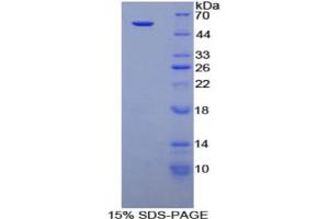 SDS-PAGE analysis of Mouse Netrin 1 Protein. (Netrin 1 Protein (NTN1))