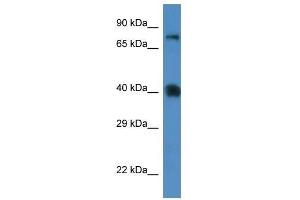 Western Blot showing Slc7a3 antibody used at a concentration of 1. (SLC7A3 antibody  (Middle Region))