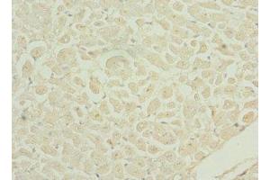 Immunohistochemistry (IHC) image for anti-DNA-Damage Regulated Autophagy Modulator 2 (DRAM2) (AA 182-266) antibody (ABIN7150145)