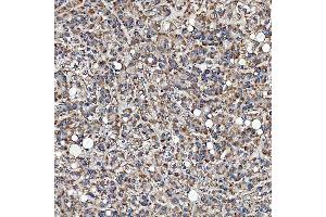 IHC analysis of SFXN3 using anti-SFXN3 antibody (ABIN7601302). (SFXN3 antibody  (AA 32-321))