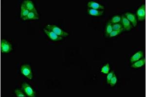 Immunofluorescent analysis of HepG2 cells using ABIN7149266 at dilution of 1:100 and Alexa Fluor 488-congugated AffiniPure Goat Anti-Rabbit IgG(H+L) (CYP3A7 antibody  (AA 1-200))