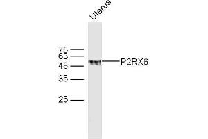 Mouse uterus lysates probed with P2RX6 Polyclonal Antibody, unconjugated  at 1:300 overnight at 4°C followed by a conjugated secondary antibody at 1:10000 for 60 minutes at 37°C.