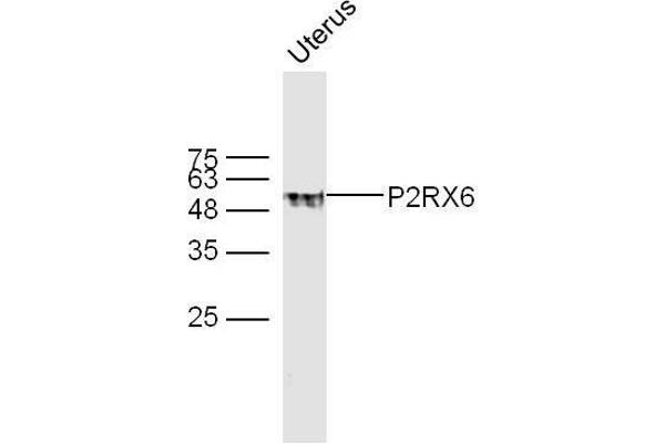 P2RX6 Antikörper  (AA 55-160)
