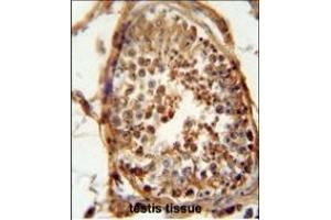 DNAJB13 antibody (Center) (ABIN654838 and ABIN2844507) immunohistochemistry analysis in formalin fixed and paraffin embedded human testis carcinoma followed by peroxidase conjugation of the secondary antibody and DAB staining. (DNAJB13 antibody  (AA 176-205))