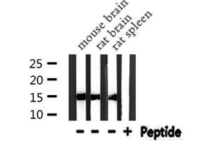 Western blot analysis of PFN1  expression in various lysates (PFN1 antibody  (C-Term))