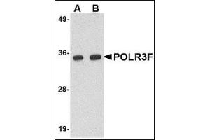 Western blot analysis of POLR3F in human brain tissue lysate with this product at (A) 0. (POLR3F antibody  (N-Term))