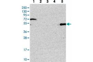 Western blot analysis of Lane 1: RT-4, Lane 2: U-251 MG, Lane 3: Human Plasma, Lane 4: Liver, Lane 5: Tonsil with SETD6 polyclonal antibody .