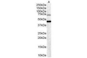 Image no. 1 for anti-Forkhead Box G1 (FOXG1) (C-Term) antibody (ABIN374263) (FOXG1 antibody  (C-Term))