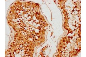 IHC image of ABIN7159140 diluted at 1:500 and staining in paraffin-embedded human testis tissue performed on a Leica BondTM system. (MED26 antibody  (AA 372-523))