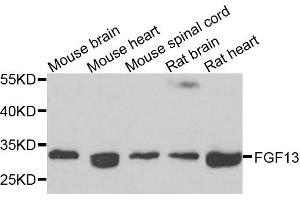 Western blot analysis of extracts of various cells, using FGF13 antibody. (FGF13 antibody)