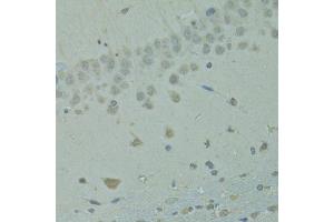 Immunohistochemistry of paraffin-embedded rat brain using IVNS1ABP antibody (ABIN1873334) at dilution of 1:100 (40x lens). (IVNS1ABP antibody)