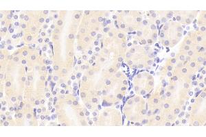 Detection of RBP4 in Mouse Kidney Tissue using Polyclonal Antibody to Retinol Binding Protein 4 (RBP4) (RBP4 antibody  (AA 63-245))