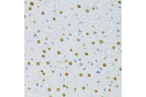 Immunohistochemistry of paraffin-embedded rat liver using SNRNP70 antibody (ABIN1877092) at dilution of 1:100 (40x lens).