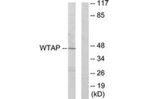 Western blot analysis of extracts from HuvEc cells, using WTAP Antibody. (WTAP antibody  (AA 321-370))